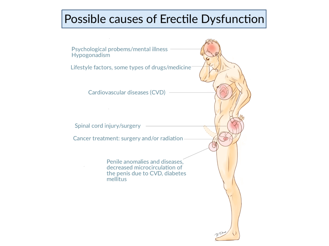 Causes_of_ED