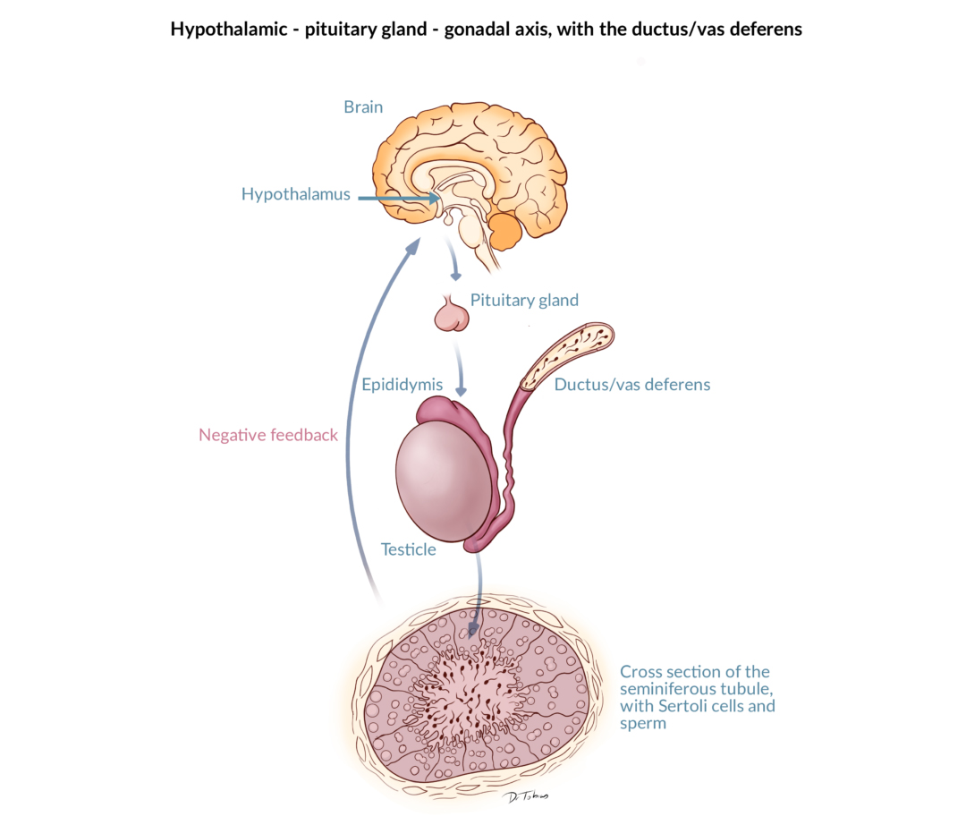 Hypogonadotropic_Hypogonadism